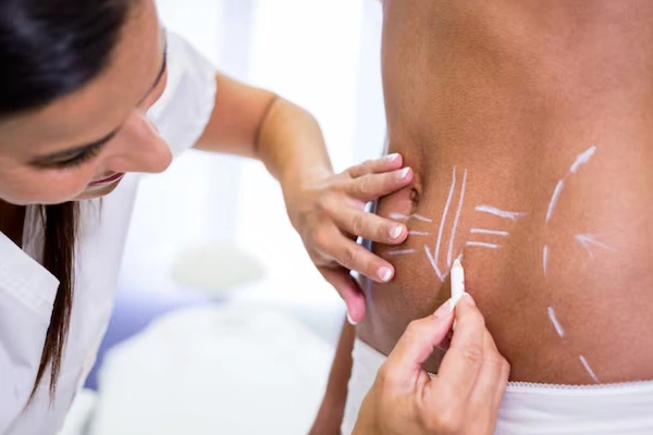 Scar Treatment
