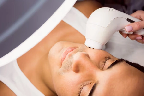Laser Treatments