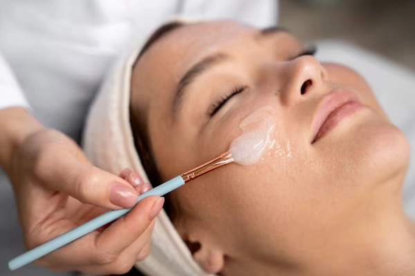 Chemical Peel